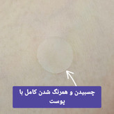 چسب جوش اورجینال برند کاریته